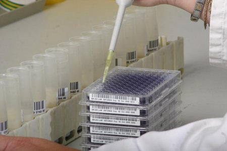 Pipette mit Milch auf einer Laborplatte